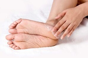 ayak derisi mantar kremi tedavisi